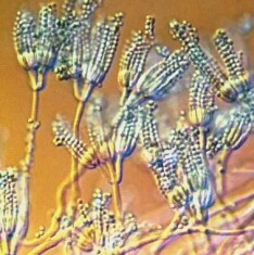 penicillium-digitatum-de-tecnicos-agrícolas