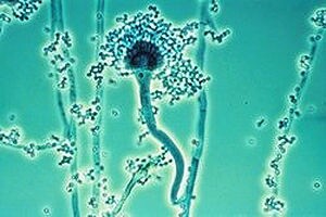 aspergillus-by-wikipedia