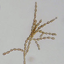 cladosporium