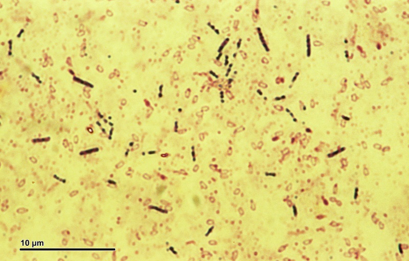 1200px-eubacteria-(259-11)-bacillus-subtilis-bacteria